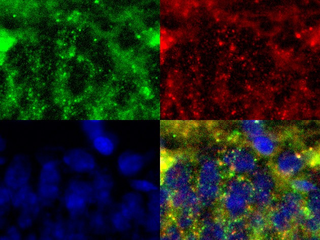Four-panel fluorescence microscopy montage of brain tissue: phospho-IGF2R in one channel, a co-marker in a second, nuclei labeled with DAPI in blue, and a merged image showing overlapping signal.